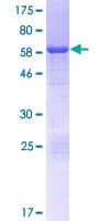 Human HDGFL1 Protein (Recombinant GST)