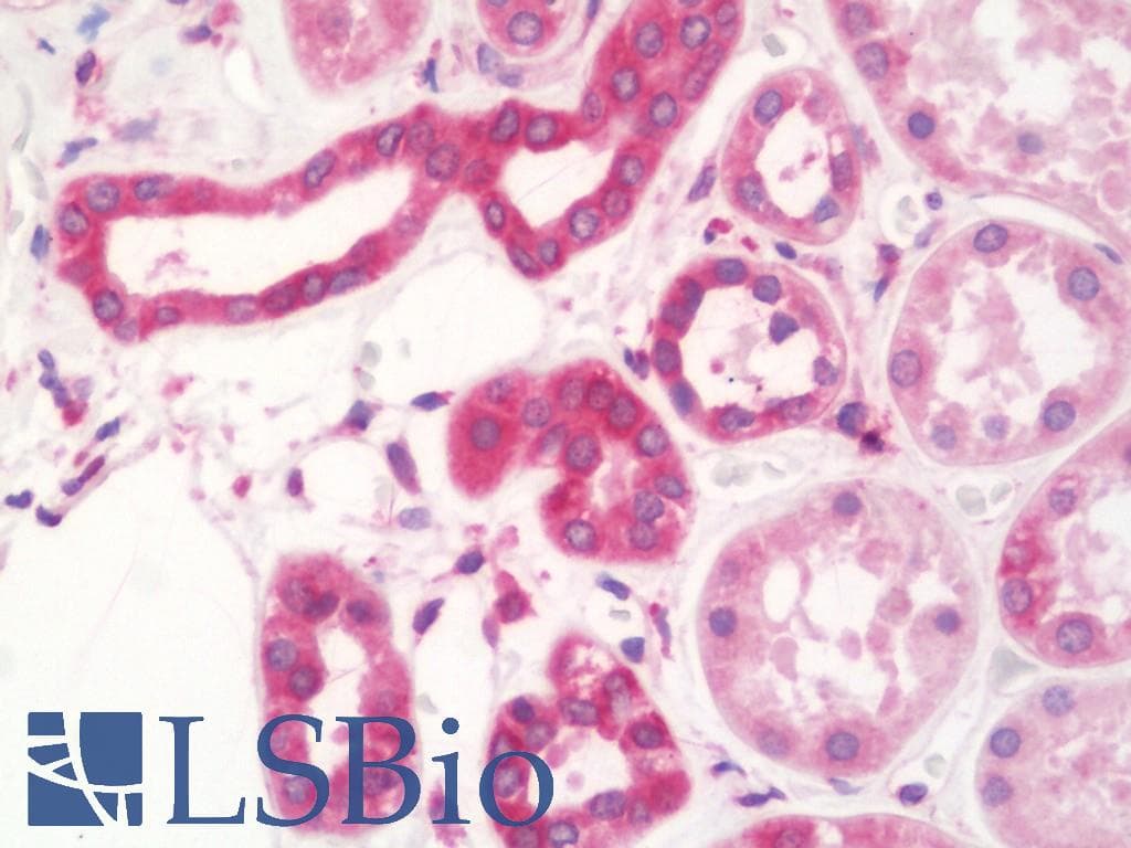 IHC-plus™ Monoclonal Mouse anti-Human DIXDC1 Antibody (clone 6B6, IHC, IF, WB)