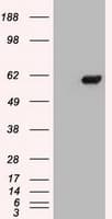 Monoclonal Mouse anti-Human CHEK2 / CHK2 Antibody (clone OTI5C7, IHC, WB)