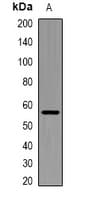 SLC1A4 / ASCT1 Antibody