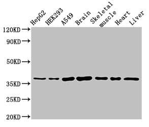 Polyclonal Rabbit anti-Human MYF6 / MRF4 Antibody (IHC, IF, WB)