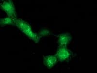 Monoclonal Mouse anti-Human DTNA / Dystrobrevin Alpha Antibody (clone OTI1G1, IF, WB)