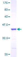 Human GGA1 Protein (Recombinant GST)