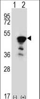 FEN1 Antibody (aa243-272)