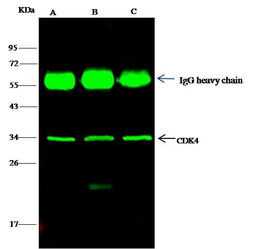 Polyclonal Rabbit anti-Human CDK4 Antibody (Preservative Free, IHC, IF, WB)