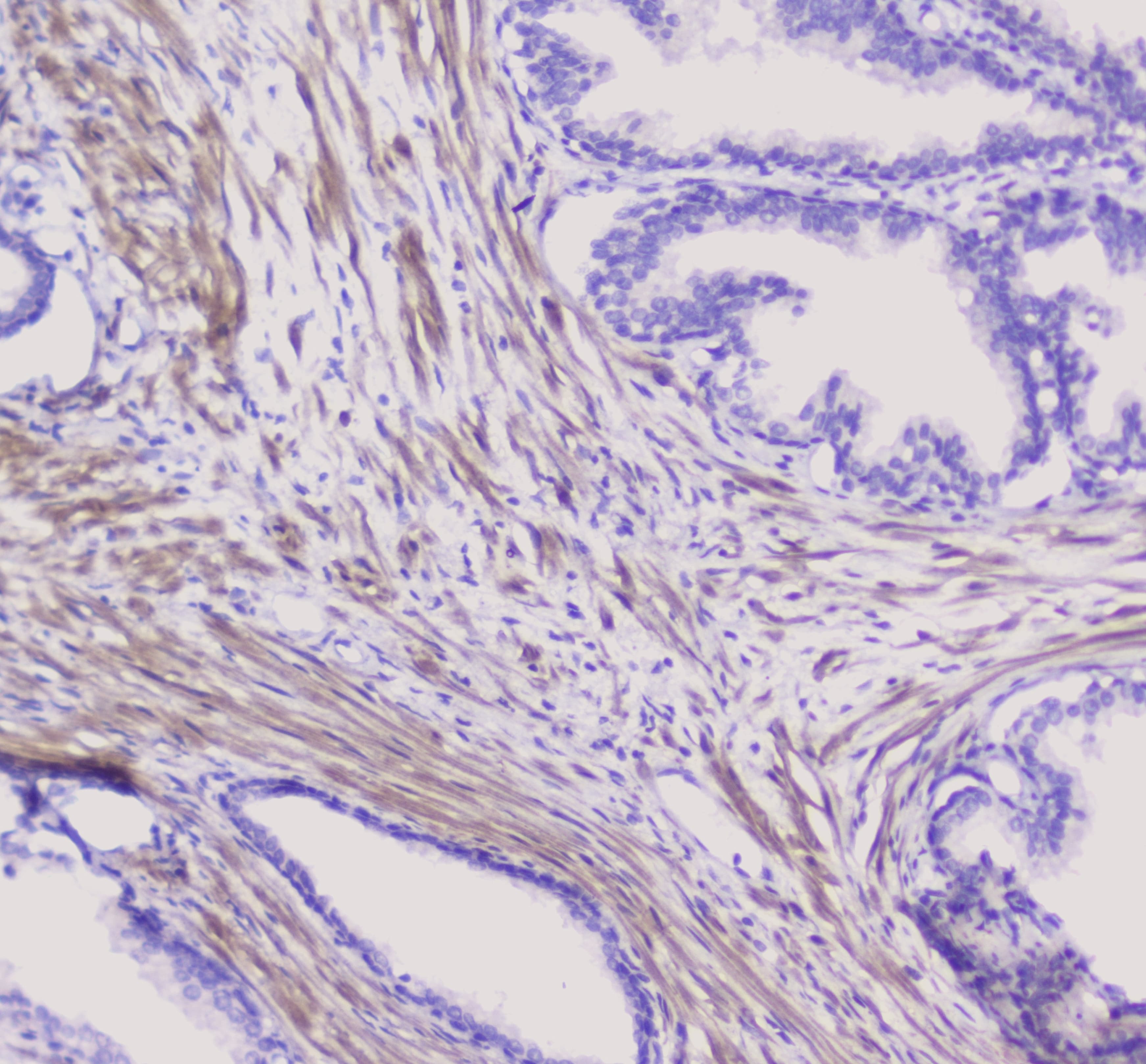 ENO2 / NSE Antibody