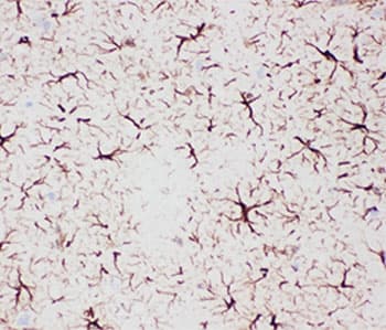 Polyclonal Rabbit anti-Human GFAP Antibody (IHC, WB)