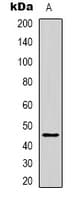MCAD / ACADM Antibody (Internal)