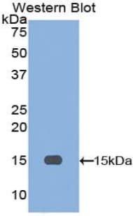 INHBA / Inhibin Beta A Antibody (aa309-424)
