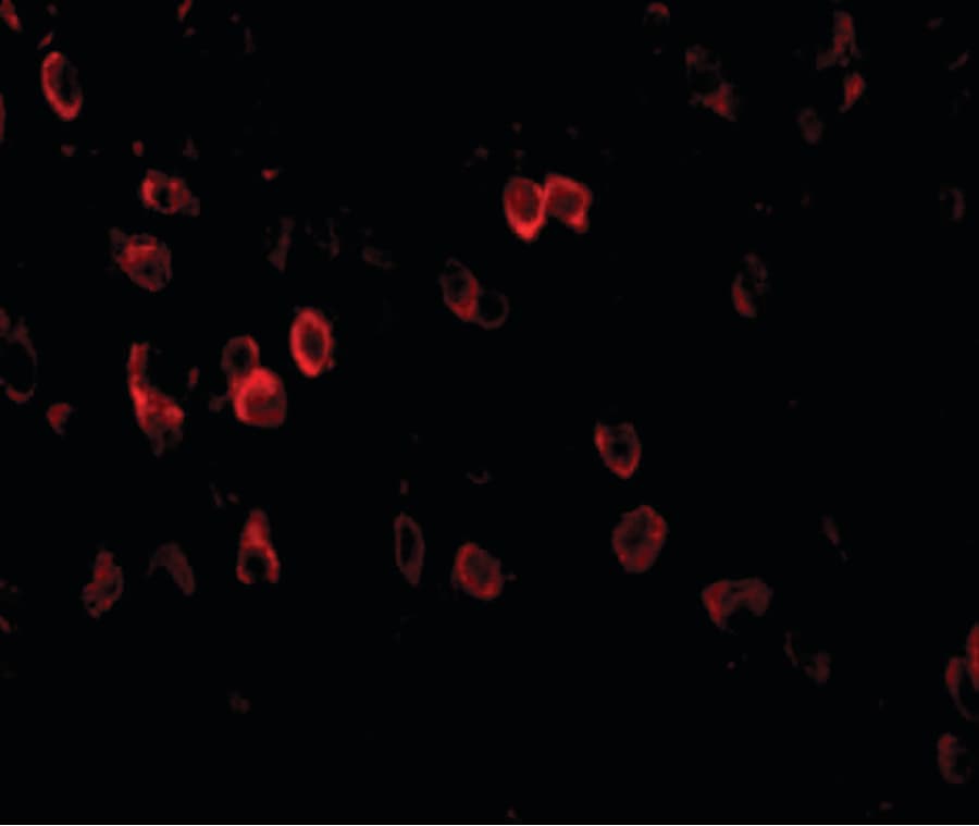 APP / Beta Amyloid Precursor Antibody