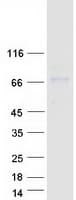 Human TOR1AIP1 / LAP1 Protein (Recombinant Myc-DDK (Flag))