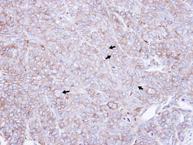 CAP1 Antibody (aa266-475)
