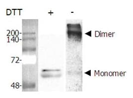 Human NAMPT / Visfatin Protein (Recombinant His)