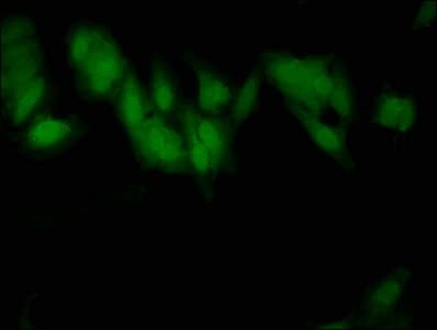 Polyclonal Rabbit anti-Human SLC2A4 / GLUT-4 Antibody (aa223-287, IHC, WB)