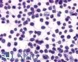 PathPlus™ ADGRE5 / CD97 Antibody (N-Terminus)