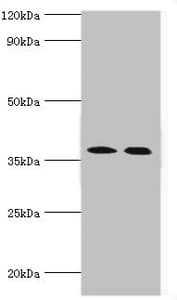 CA14 / Carbonic Anhydrase XIV Antibody