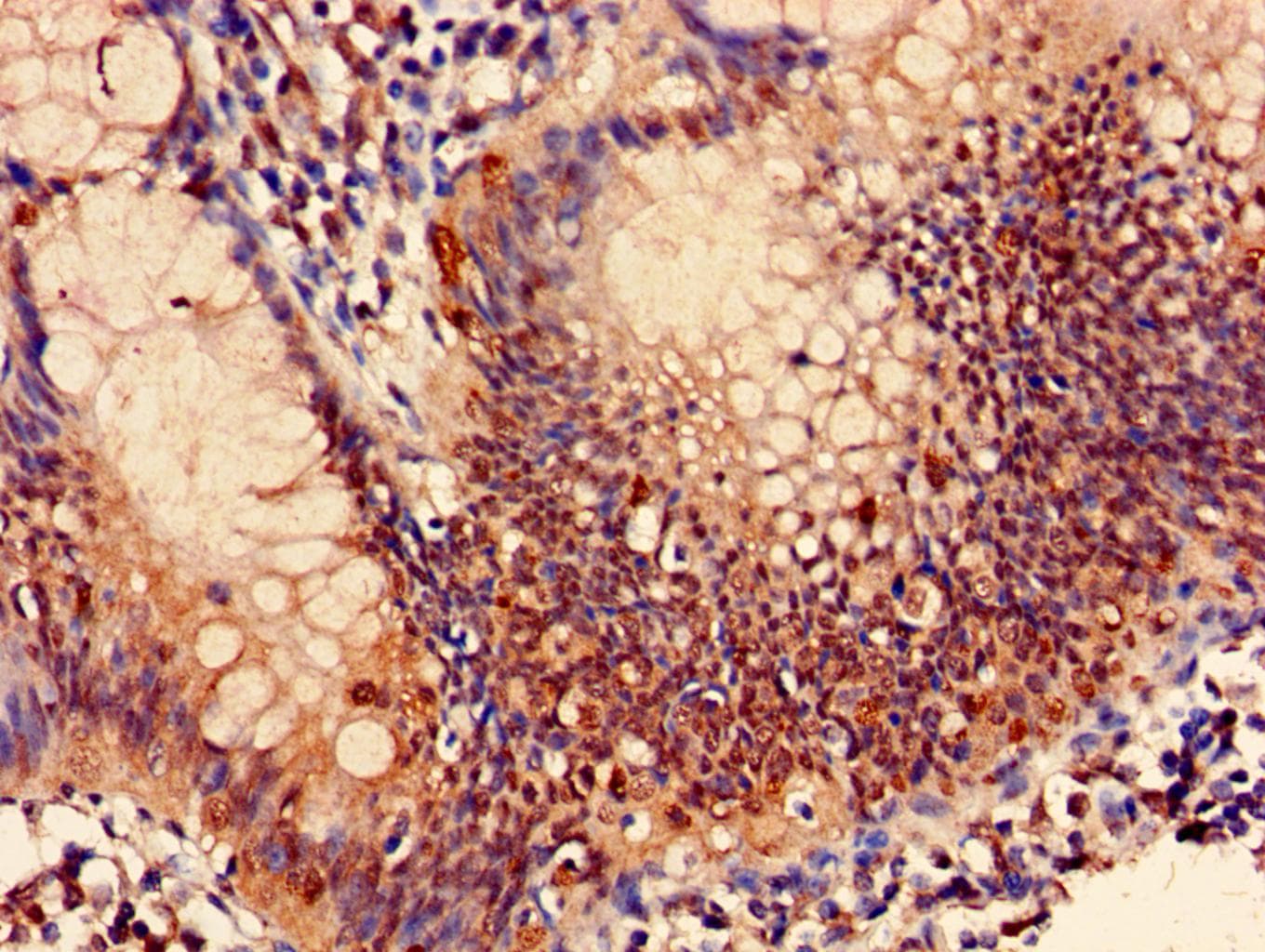 PSMB7 Antibody