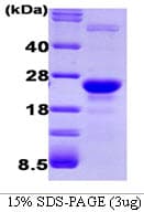 Human GLO1 / Glyoxalase I Protein (Recombinant)