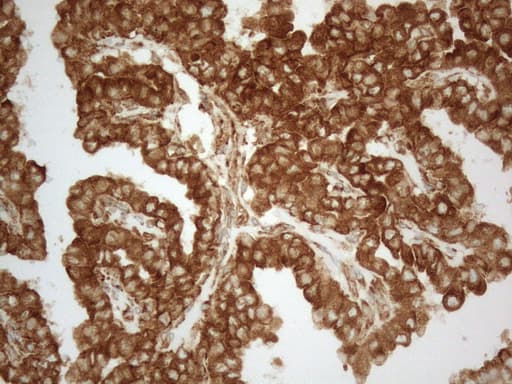 VAP33 / VAPA Antibody (aa2-227, clone OTI10E10)