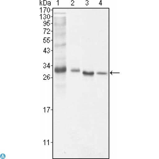BCL10 / BCL-10 Antibody