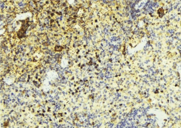 Polyclonal Rabbit anti-Human STX1A / Syntaxin 1A Antibody (IHC, IF, WB)