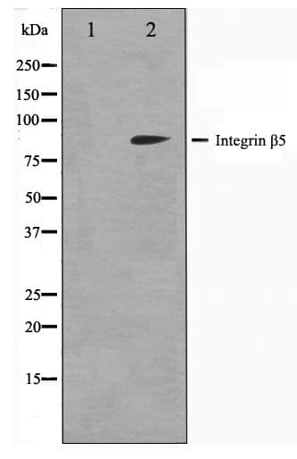 ITGB5 / Integrin Beta 5 Antibody