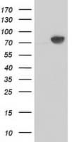 CTNNB1 / Beta Catenin Antibody (clone OTI11H9)