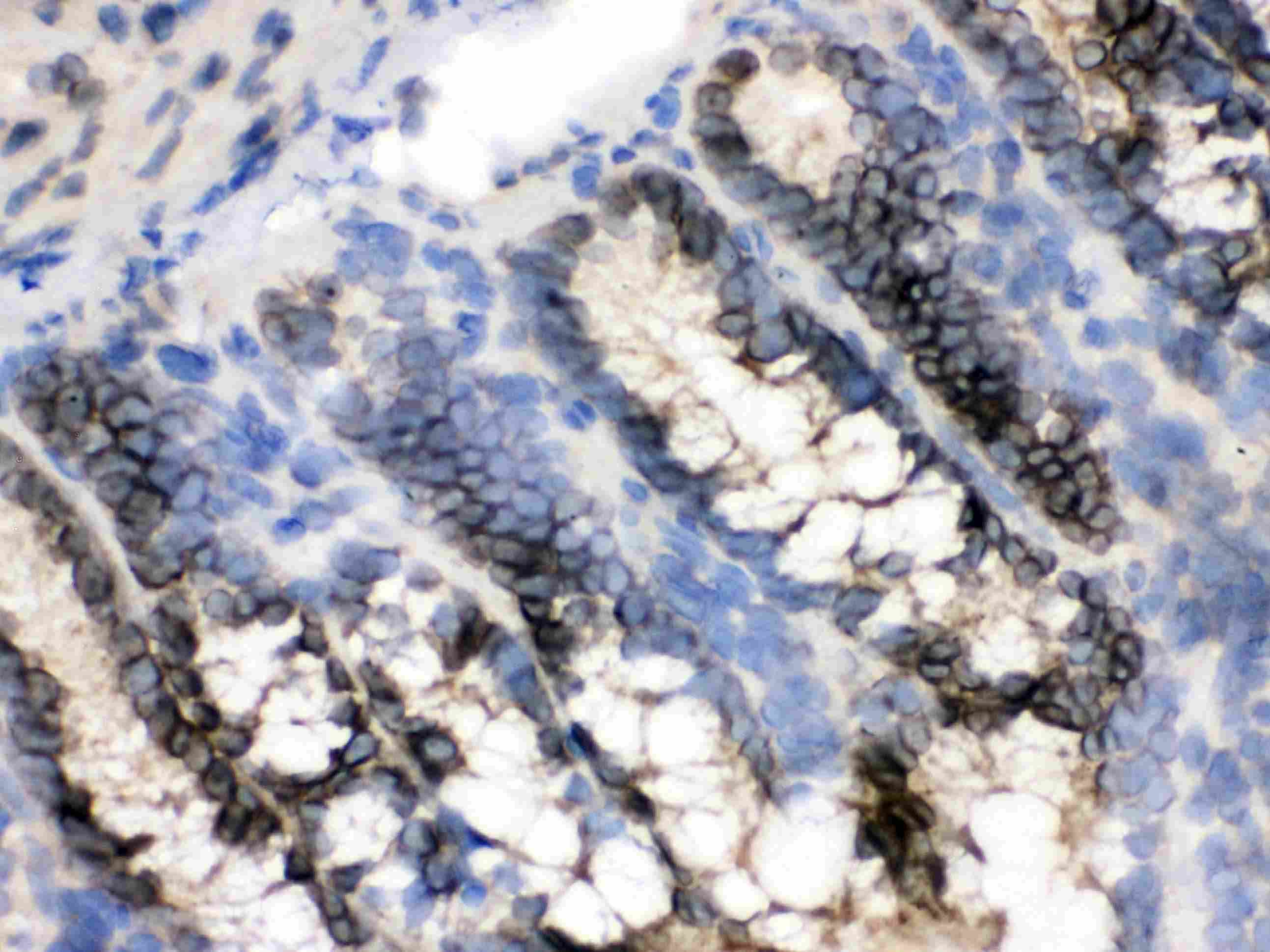XPO1 / CRM1 Antibody