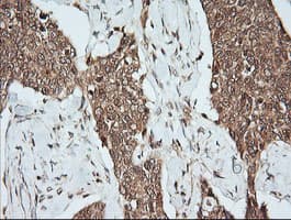 MAP2K1 / MKK1 / MEK1 Antibody (clone OTI7E2)