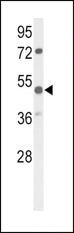 PARVA Antibody (aa323-351)