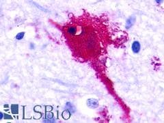 PathPlus™ C5AR2 / GPR77 / C5L2 Antibody (C-Terminus)