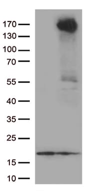 Monoclonal Mouse anti-Human RET Antibody (clone OTI2G6, Carrier-free, aa713-1017, WB)