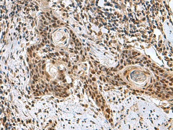 PRPF40A / FNBP3 Antibody