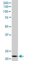 Monoclonal Mouse anti-Human NDUFV2 Antibody (clone 1A10, WB)