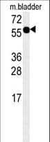 ADSSL1 Antibody (aa96-123)