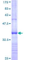 Human ADAMTS13 Protein (Recombinant GST, N-terminus)