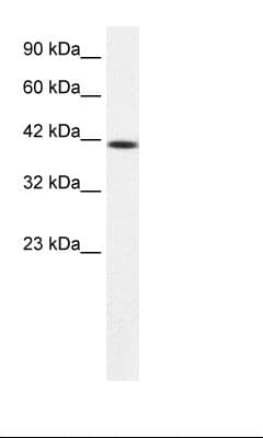 PTK2B / PYK2 Antibody (aa812-861)