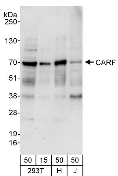 CARF / ALS2CR8 Antibody (aa225-275)
