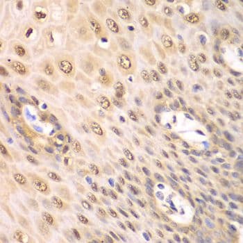PSMA2 Antibody