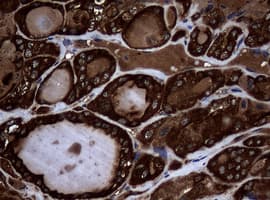 NME1 / NM23 Antibody (clone OTI6E8)
