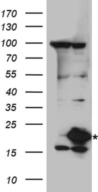 UBE2L3 / UBCH7 Antibody