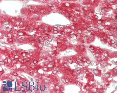 IHC-plus™ Monoclonal Mouse anti-Human RAB3B Antibody (clone 3F12, IHC, IF, WB)