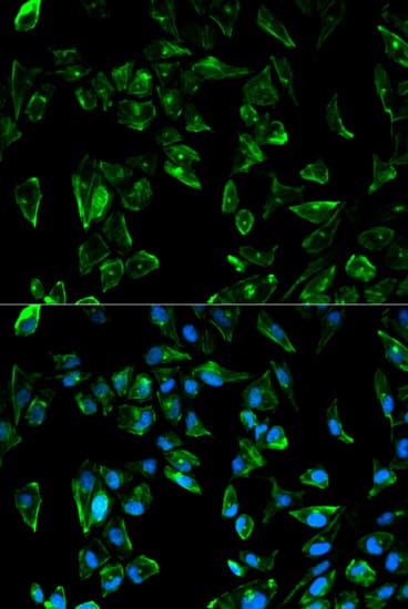 IHC-plus™ TPM3 Antibody
