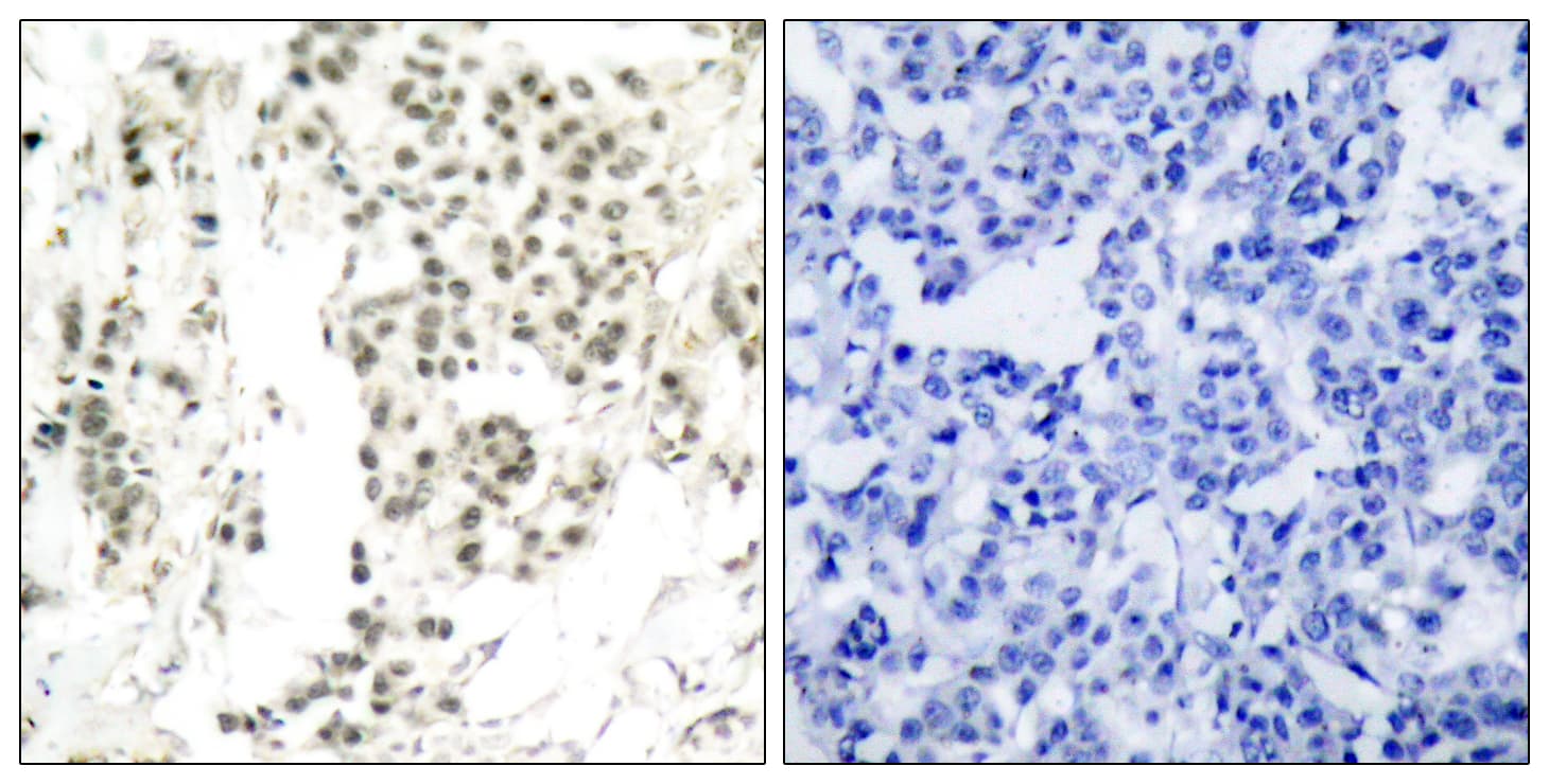 CHEK1 / CHK1 Antibody (phospho-Ser345)