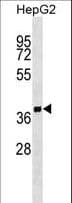 SCAMP2 Antibody (aa119-147)