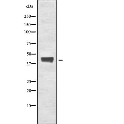 FCMR / FAIM3 Antibody