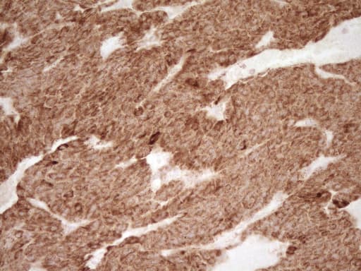 Monoclonal Mouse anti-Human SFRP2 Antibody (clone OTI6C2, Carrier-free, aa25-295, IHC, WB)