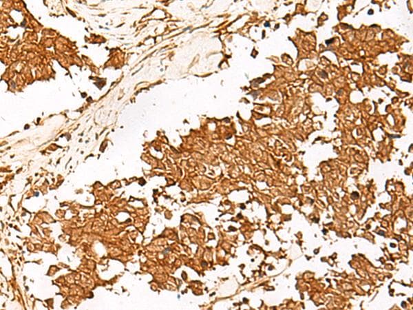 Polyclonal Rabbit anti-Human HUS1 Antibody (IHC)