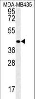 Polyclonal Rabbit anti-Human VASH2 Antibody (aa216-245, WB)