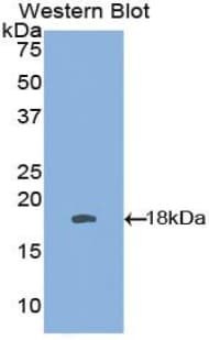 IFN Gamma / Interferon Gamma Antibody (aa20-164, APC)